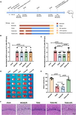 Transcutaneous electrical acupoint stimulation alleviates cerebral ischemic injury through the TLR4/MyD88/NF-κ B pathway